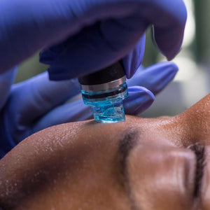 Hydrafacial 3er-Kur – Für porentiefe Reinigung & strahlende Haut